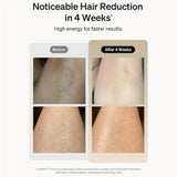 Professional Laser Epilator IPL Hair Removal Body Bikini Leg Depilatory Devic 900,000 Flashes 5 Levels Epilator Painless Electric Epilator Machine - Nook & Nest